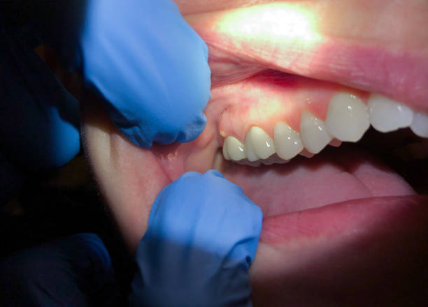 Dentist for Dental Trauma in MA