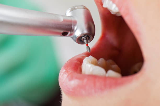 Best Urgent Tooth Repair  in Salem, MA